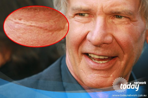 Harrison Fords Scar